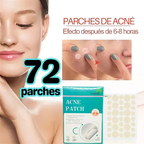 Parches para Acné - Tratamiento Invisible 24 Horas